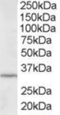 ING2 Goat anti-Human, Polyclonal, Novus Biologicals 100 &mu;g; Unconjugated:Antibodies,